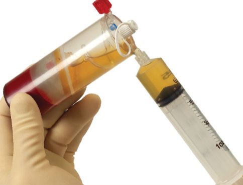 PRP 02